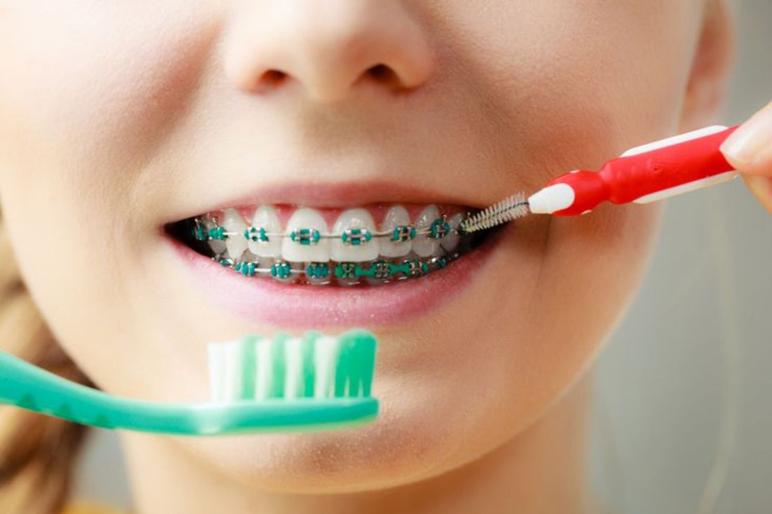 Dental Care for Teens: Navigating Braces and Wisdom Teeth