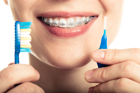 Orthodontic Care Products: Maintaining Braces and Aligners