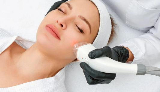 Laser Therapy for Acne: What You Need to Know