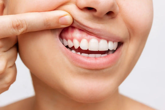 How to Care for Your Gums: Preventing Gingivitis and Periodontitis