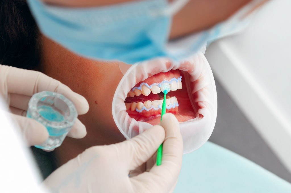 Risks and Benefits of Cosmetic Dental Procedures