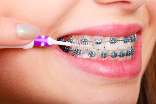 Dental Care During Orthodontic Treatment