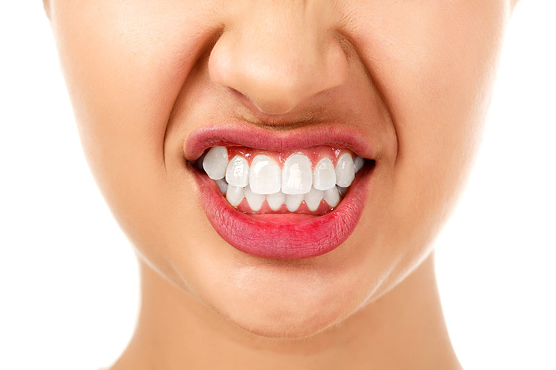 Bruxism (Teeth Grinding): Symptoms and Treatment Options